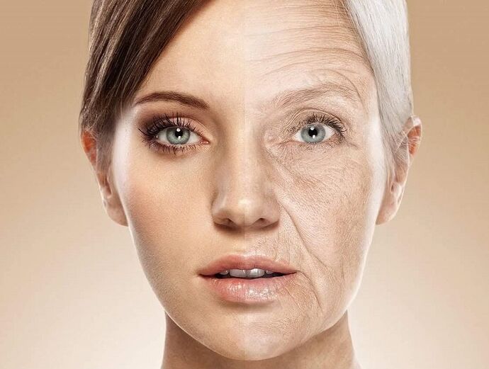 Piel facial antes y después del rejuvenecimiento con láser. 